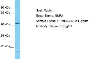 Host: Rabbit Target Name: NUF2 Sample Type: RPMI-8226 Whole Cell lysates Antibody Dilution: 1. (NUF2 antibody  (N-Term))