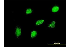 Immunofluorescence of monoclonal antibody to HEYL on HeLa cell.