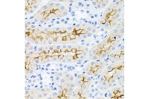 Immunohistochemistry of paraffin-embedded mouse kidney using IL17A antibody (ABIN6290529) at dilution of 1:100 (40x lens). (Interleukin 17a antibody)