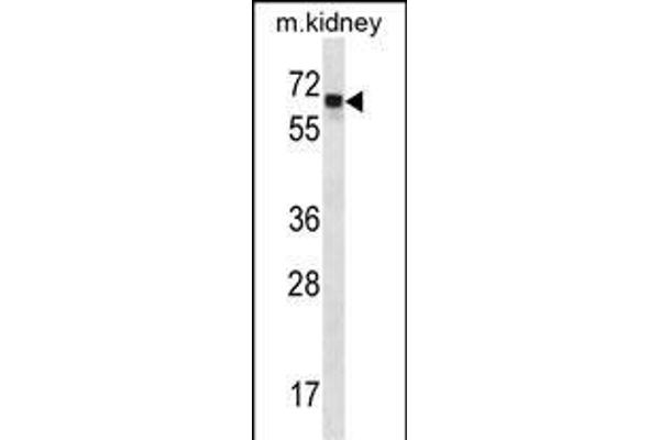 Angiopoietin 2 antibody  (C-Term)