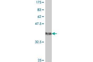 Western Blot detection against Immunogen (37. (ITGB6 antibody  (AA 604-707))