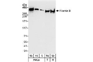 Western Blotting (WB) image for anti-Filamin B, beta (FLNB) (AA 2552-2602) antibody (ABIN7454539)