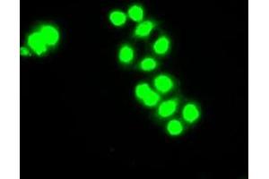 Image no. 1 for anti-Checkpoint Kinase 2 (CHEK2) antibody (ABIN1497495) (CHEK2 antibody)