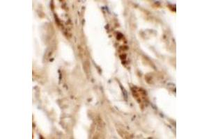 Immunohistochemistry of DBX2 in human kidney tissue with DBX2 antibody at 5 ug/mL. (DBX2 antibody  (N-Term))