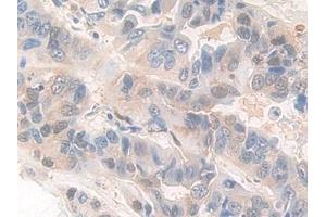 Immunohistochemistry (IHC) image for anti-Pyridoxal Kinase (PDXK) (AA 29-253) antibody (ABIN7440257)