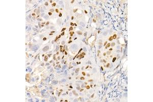 Immunohistochemistry (IHC) image for anti-Cyclin-Dependent Kinase Inhibitor 1A (p21, Cip1) (CDKN1A) antibody (ABIN7266599)