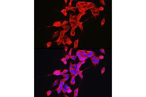 Immunofluorescence analysis of SH-SY5Y cells using α-Synuclein Rabbit pAb (ABIN6129177, ABIN6148190, ABIN6148192 and ABIN6223046) at dilution of 1:100 (40x lens). (SNCA antibody  (AA 61-140))