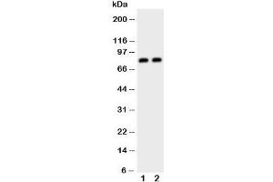 Western blot testing of Daxx antibody and Lane 1:  HeLa;  2: COLO320 cell lysate