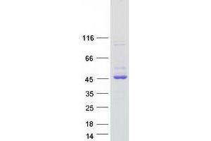 Validation with Western Blot