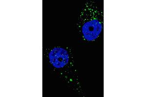 Fluorescent image of  cells stained with UVRAG (C-term) antibody. (UVRAG antibody  (C-Term))
