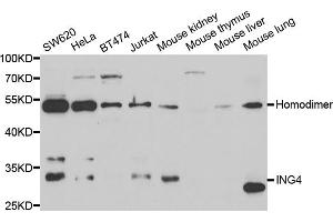 Western blot analysis of extracts of various cell lines, using ING4 antibody (ABIN5973446) at 1/1000 dilution.