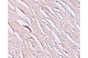 Immunohistochemical staining of human brain cells with SLC39A2 polyclonal antibody  at 2. (ZIP2 antibody  (N-Term))