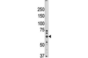 Western blot analysis of HRD1 antibody and mouse brain tissue lysate. (SYVN1 antibody  (AA 58-88))