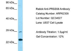 Western Blotting (WB) image for anti-Protease, serine, 58 (PRSS58) (C-Term) antibody (ABIN2789104) (PRSS58 antibody  (C-Term))