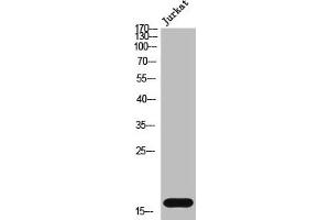 Western Blot analysis of Jurkat cells using Cystatin SN Polyclonal Antibody (CST1 antibody  (Internal Region))