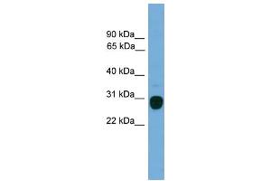 WB Suggested Anti-TREM2 Antibody Titration:  0. (TREM2 antibody  (Middle Region))