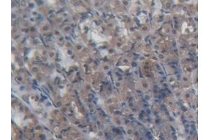 Detection of PDP2 in Rat Stomach Tissue using Polyclonal Antibody to Pyruvate Dehydrogenase Phosphatase 2 (PDP2) (PDP2 antibody  (AA 1-187))