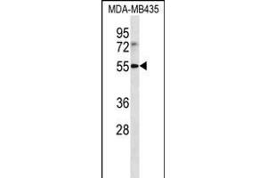 LILRB4 Antibody (N-term) (ABIN656231 and ABIN2845546) western blot analysis in MDA-M cell line lysates (35 μg/lane). (LILRB4 antibody  (N-Term))