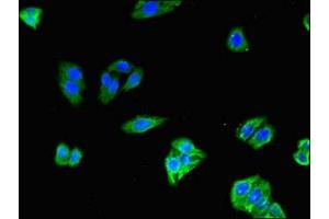 Immunofluorescent analysis of HepG2 cells using ABIN7170295 at dilution of 1:100 and Alexa Fluor 488-congugated AffiniPure Goat Anti-Rabbit IgG(H+L) (SLCO1C1 antibody  (AA 297-348))