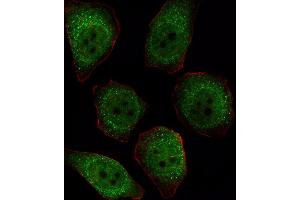 Fluorescent image of  cell stained with P1CB Antibody (C-term) (ABIN392847 and ABIN2842269).