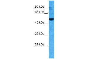 Host:  Mouse  Target Name:  ACVR2B  Sample Tissue:  Mouse Testis  Antibody Dilution:  1ug/ml (ACVR2B antibody  (Middle Region))