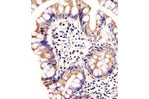 Immunohistochemical analysis of paraffin-embedded H. (CARD6 antibody)