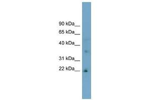 LDLRAD1 antibody used at 1 ug/ml to detect target protein. (LDLRAD1 antibody  (Middle Region))