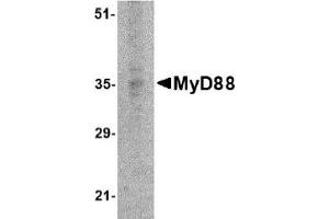 Western Blotting (WB) image for anti-Myeloid Differentiation Primary Response Gene (88) (MYD88) (AA 176-280) antibody (ABIN492527) (MYD88 antibody  (AA 176-280))