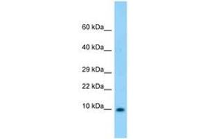 Image no. 1 for anti-S100 Calcium Binding Protein B (S100B) (AA 27-76) antibody (ABIN6748322) (S100B antibody  (AA 27-76))