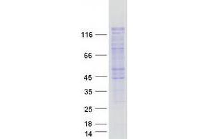 Validation with Western Blot (SMARCAD1 Protein (Transcript Variant 3) (Myc-DYKDDDDK Tag))