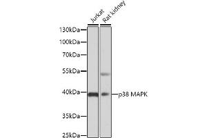 Western blot analysis of extracts of various cell lines, using p38 MAPK antibody (ABIN6130006, ABIN6143525, ABIN6143527 and ABIN6221180) at 1:3000 dilution. (MAPK14 antibody  (AA 1-360))