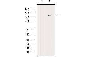 Western blot analysis of extracts from B16F10, using NFAT4 Antibody. (NFATC3 antibody  (N-Term))