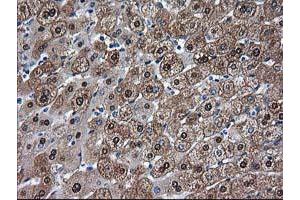 Immunohistochemical staining of paraffin-embedded Human liver tissue using anti-ADH1B mouse monoclonal antibody.
