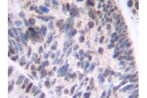 Image no. 3 for anti-Tumor Necrosis Factor Receptor Superfamily, Member 11b (TNFRSF11B) antibody (ABIN464948) (Osteoprotegerin antibody)