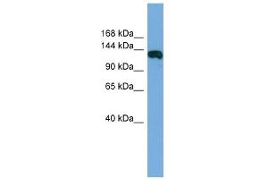 WB Suggested Anti-FAM29A Antibody Titration: 0. (FAM29A antibody  (Middle Region))