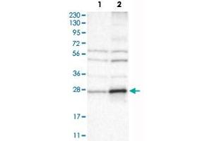 Western Blot analysis of Lane 1: RT-4 and Lane 2: U-251 MG sp cell lysates with CYBRD1 polyclonal antibody . (Cytochrome B Reductase 1 antibody)