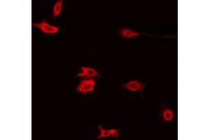 ABIN6272395 staining Hela by IF/ICC. (PXMP4 antibody  (N-Term))