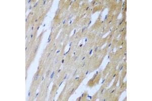 Immunohistochemistry of paraffin-embedded rat heart using ROCK1 antibody at dilution of 1:100 (40x lens).