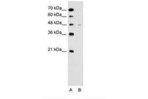 SLC43A3 Antikörper  (N-Term)