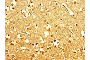 Immunohistochemistry of paraffin-embedded human brain tissue using ABIN7151354 at dilution of 1:100