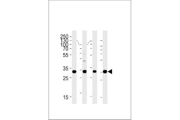 HOXB2 Antikörper  (C-Term)