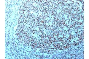 Formalin-fixed, paraffin-embedded human Tonsil stained with Nucleolin Monoclonal Antibody (364-5 + NCL/902). (Nucleolin antibody)