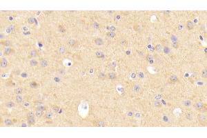 Detection of LDLR in Mouse Cerebrum Tissue using Polyclonal Antibody to Low Density Lipoprotein Receptor (LDLR) (LDLR antibody  (AA 263-509))