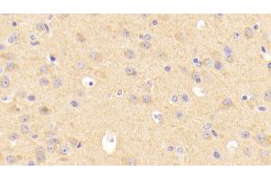 Detection of LDLR in Mouse Cerebrum Tissue using Polyclonal Antibody to Low Density Lipoprotein Receptor (LDLR) (LDLR antibody  (AA 263-509))