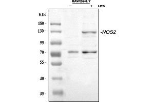 Western blot analysis of iNOS/Nos2 using anti-iNOS/Nos2 antibody (ABIN7601635).