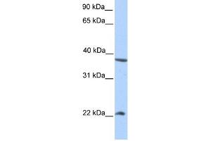 NEK7 antibody used at 1 ug/ml to detect target protein. (NEK7 antibody)