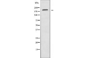 Western blot analysis of extracts from HUVEC cells, using ABCA8 antibody. (ABCA8 antibody  (Internal Region))