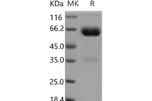 Western Blotting (WB) image for Leukocyte Immunoglobulin-Like Receptor, Subfamily A (With TM Domain), Member 5 (LILRA5) protein (Fc Tag) (ABIN7321121) (LILRA5 Protein (Fc Tag))