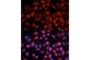 Immunofluorescence analysis of HeLa cells using ACADM antibody (ABIN3015656, ABIN3015657, ABIN1678521 and ABIN6219006) at dilution of 1:100 (40x lens). (Medium-Chain Specific Acyl-CoA Dehydrogenase, Mitochondrial (AA 1-220) antibody)