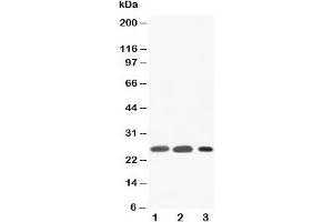 Western blot testing of SFTPA1 antibody and Lane 1:  rat lung;  2: rat lung;  3: human Raji (Surfactant Protein A1 antibody  (C-Term))